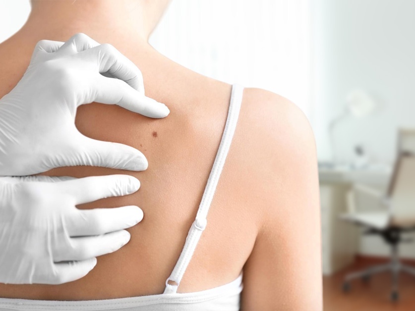 Kožní ambulance - MUDr. Zdeněk Preclík