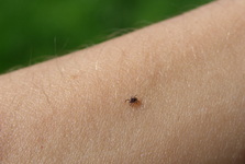Počet nakažených klíšťovou encefalitidou a lymeskou borreliózou v České republice meziročně opět vzrostl